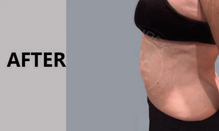 Anti Aging Facial In Manhasset
