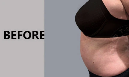 Anti Aging Facial In Manhasset
