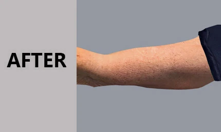 Anti Aging Facial In Manhasset
