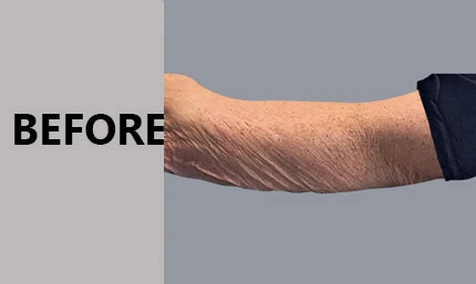 Anti Aging Facial In Manhasset
